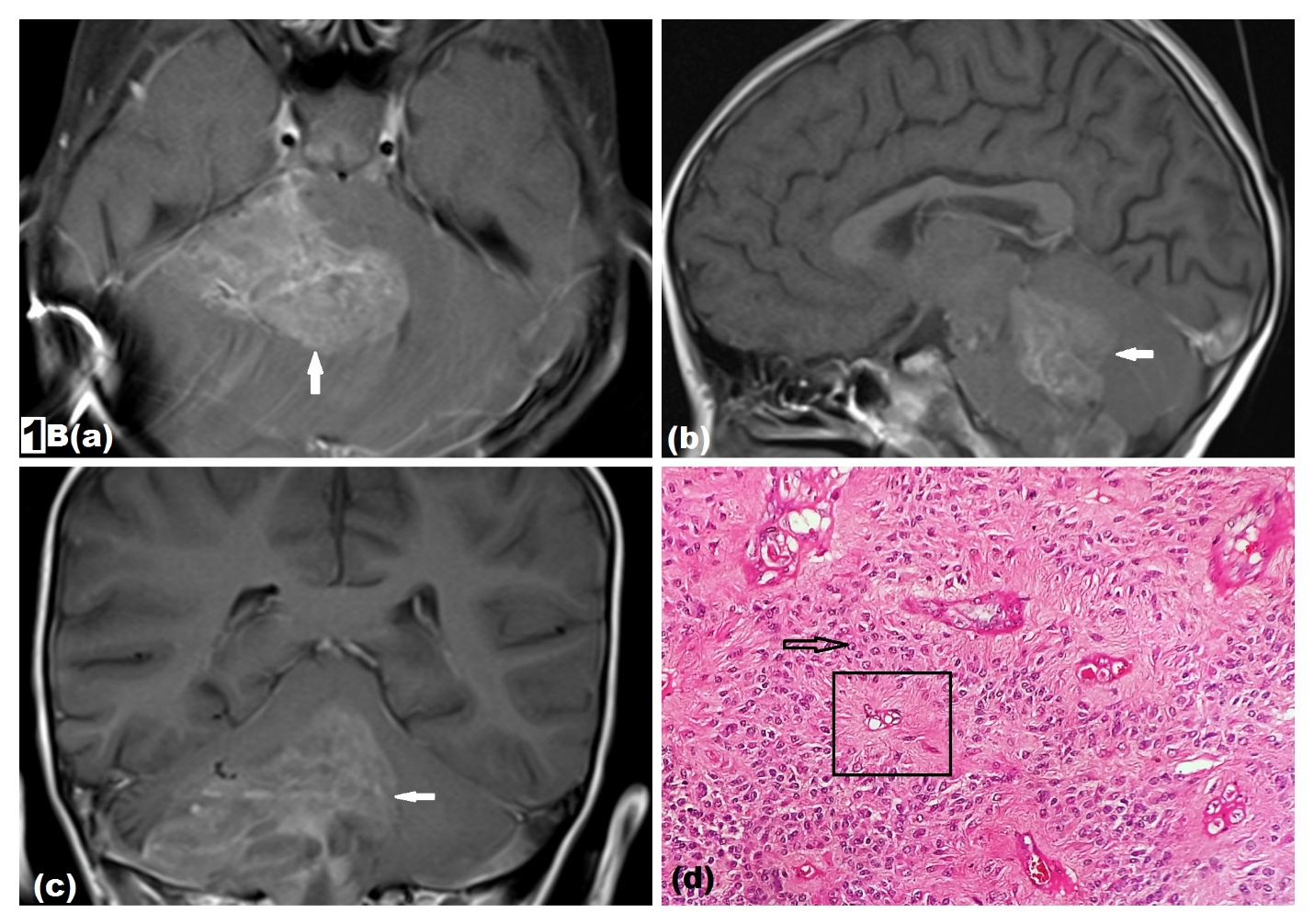 Figure 1B (a-d)