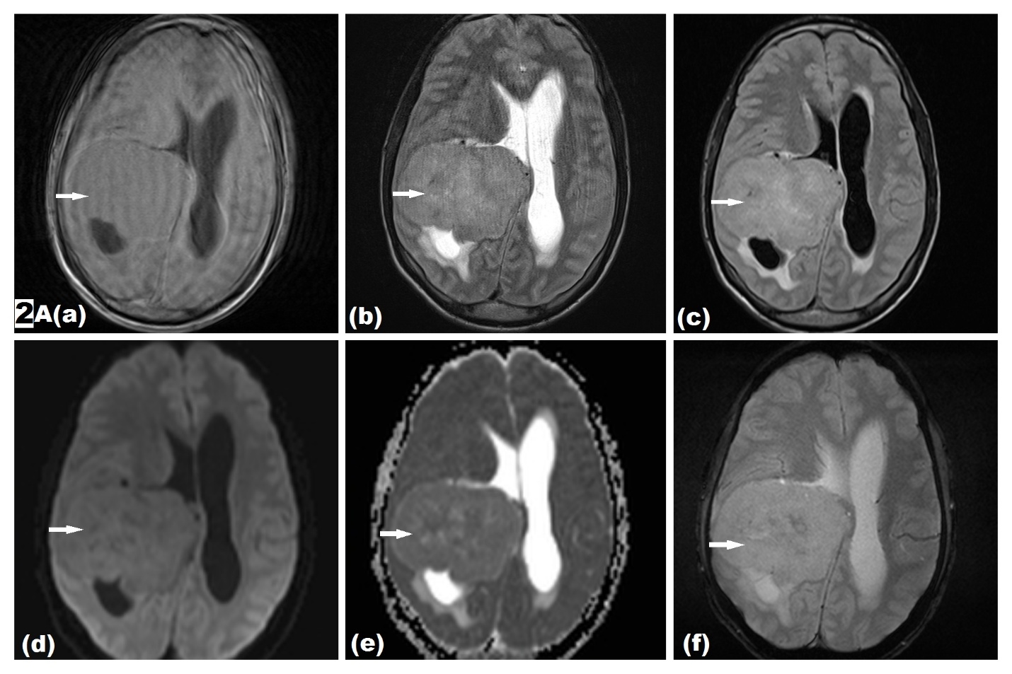 Figure 2A (a-f)