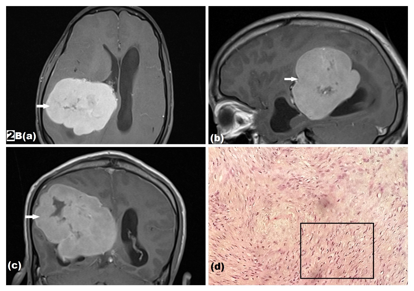 Figure 2B (a-d)