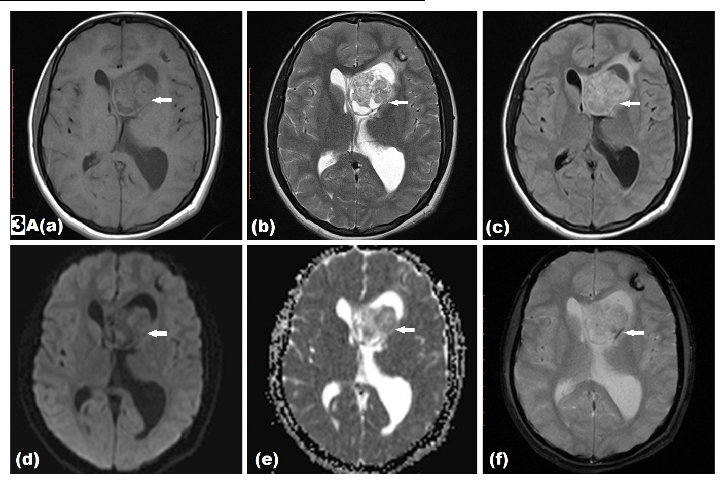 Figure 3A (a-f)