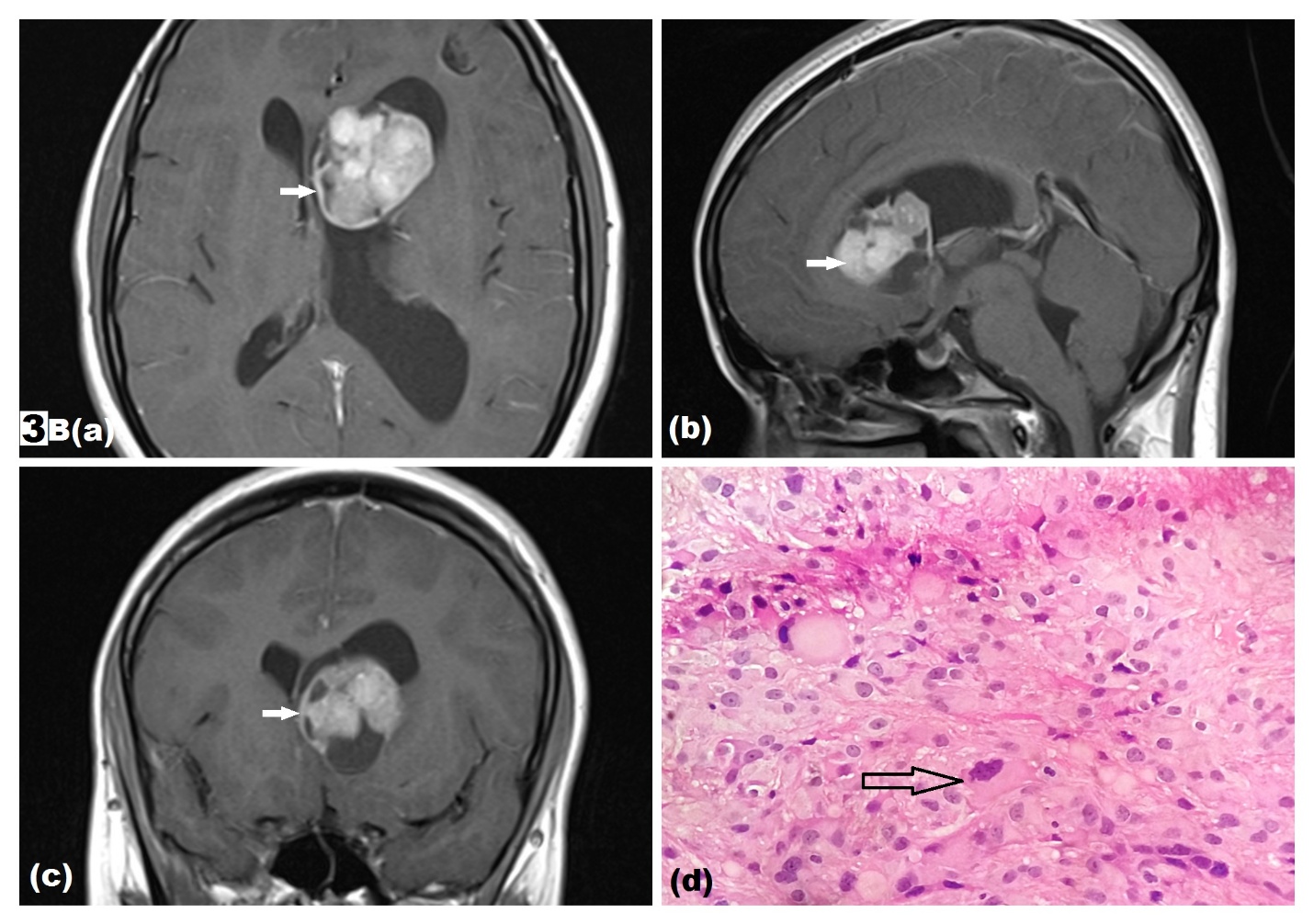 Figure 3B (a-d)